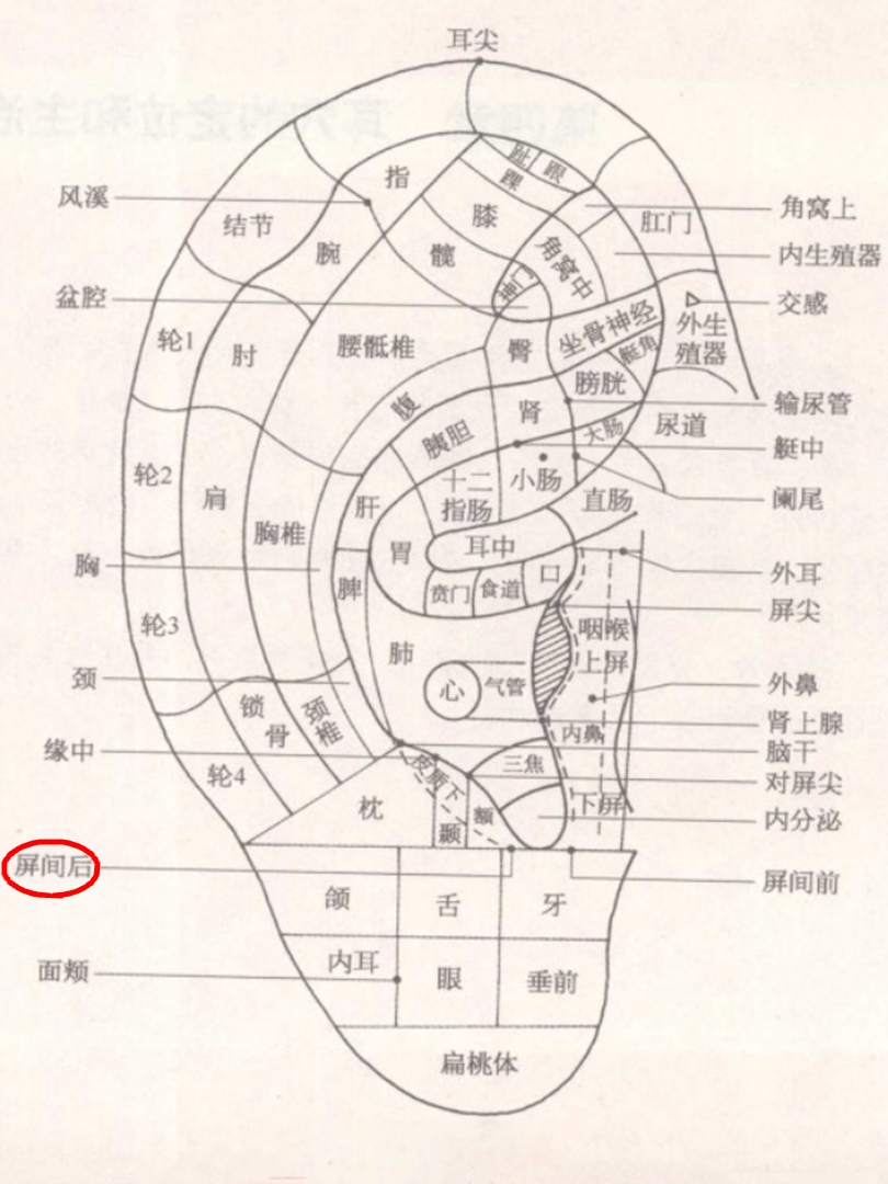 屏间后耳