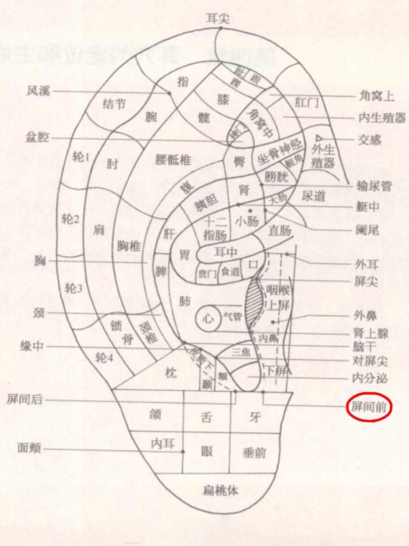 屏间前耳