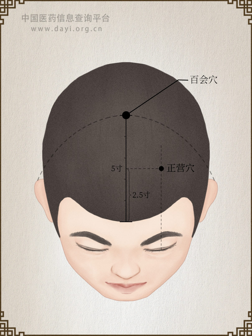 正营