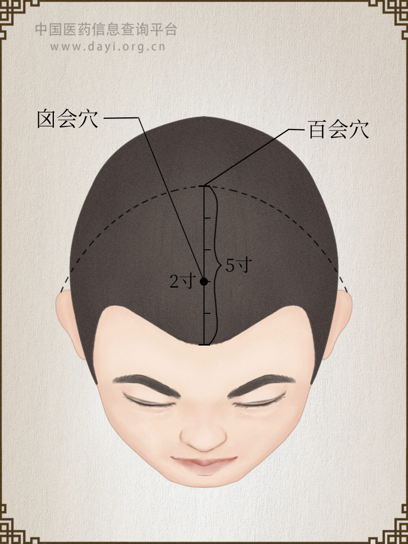 囟会
