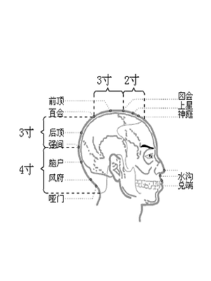 后顶