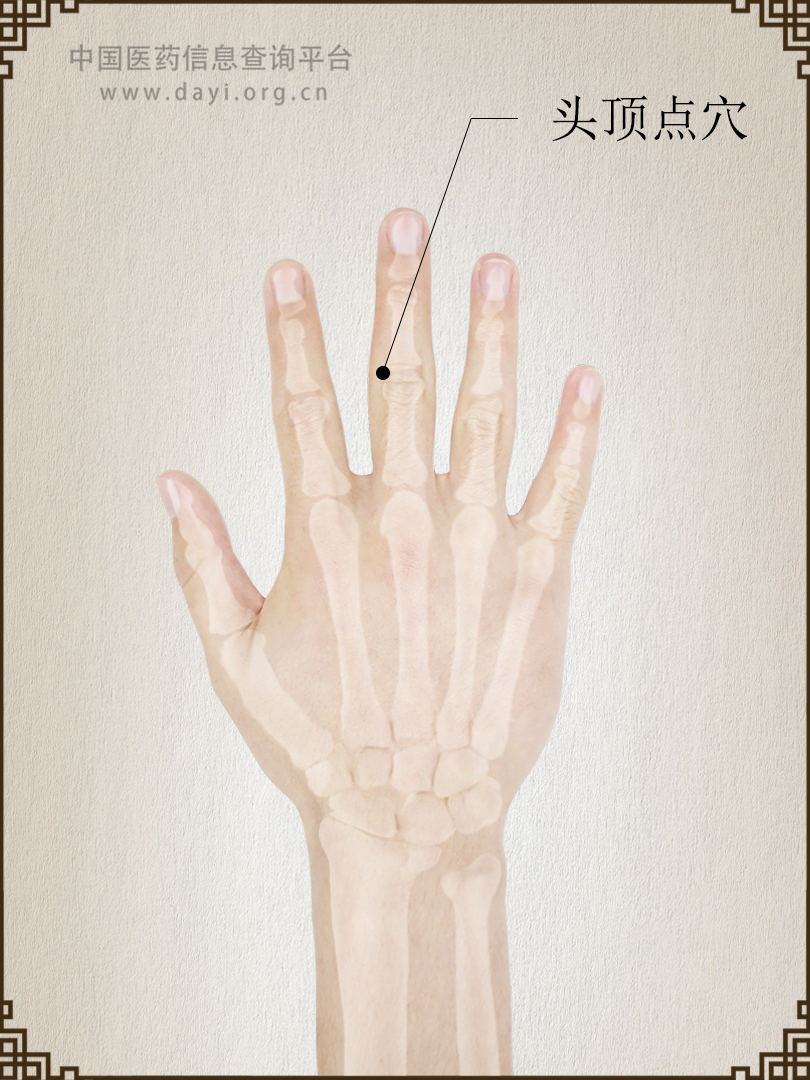 头顶点