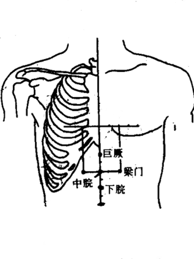 五柱灸