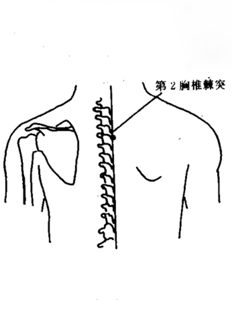 无名奇