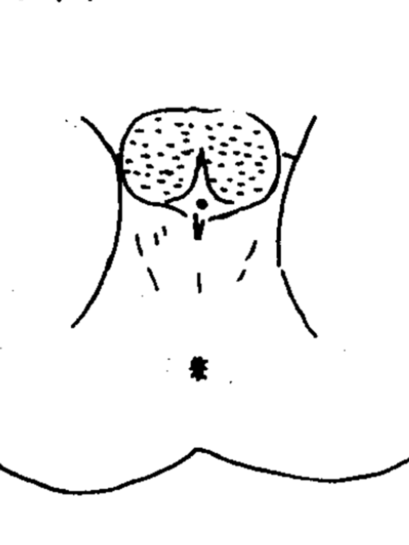 囊底