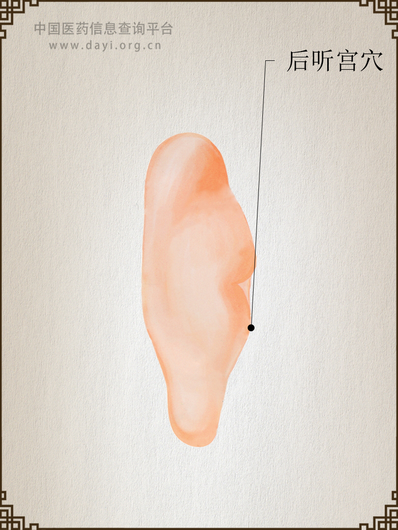 后听宫