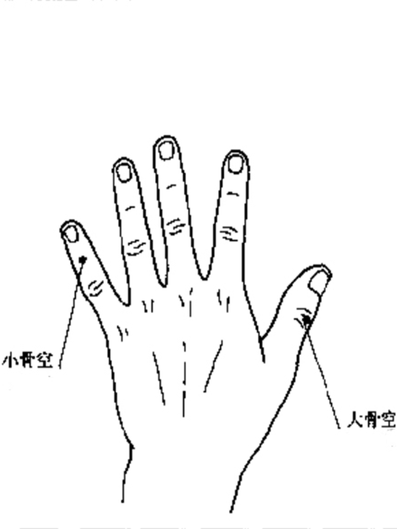 大小骨空