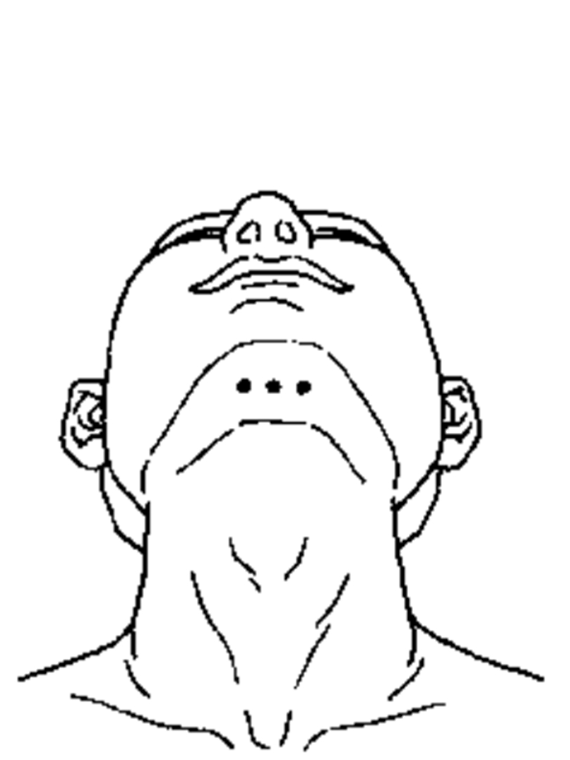 舌三针