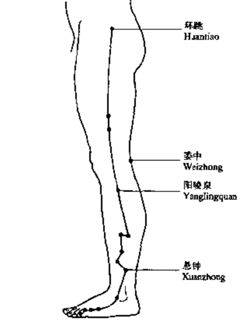 下痿痹