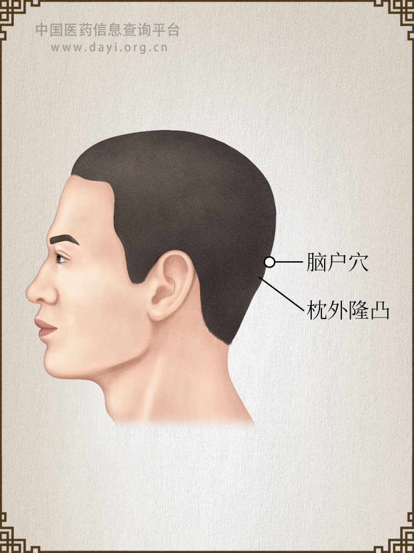 脑户